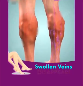 Local Ship Ready Pulse Cream Leg Earthworm Leg Herbal Cream Fast Results Hilangkan Urat Bengkak Urat Angin Urat Timbul康脉管康 蚯蚓脚软膏 Hot