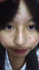 Kem Giảm Mụn Lưu Huỳnh Cephar Của Nga 30gr - Chấm Mụn Bọc Mủ Trứng Cá Lấy Sạch Bã Nhờn