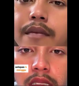 lipbalm for men Lips Serum untuk cerahkan bibir lelaki masalah bibir gelap
