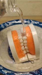 Teeth Restoration Dentures Veneers Temporary Teeth Temporary Tooth Repair Teeth Materialdenturi Denture Kit Teeth Gap Repair Denture Adhesive Resin Solid Glue False Teeth Glue Temporary Tooth 10g Replacement
