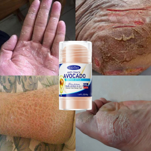 avocado foot crack cream cracked heel cream 40g 4-in-1 Anti drying dan cracking Soothes skin Moisturizing Improve roughness Suitable for the whole body