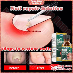 🚀SG stock🚀 Nail fungus treatment liquid / Anti paronychia relief oil / Ingrown toenail treatment / Nail repair serum / Nail fungal treatment 甲沟炎