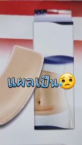 แผ่นแปะ silicone ลดรอยแผลเป็นนูน Actewound