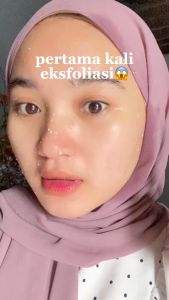 GMEELAN EXFOLIATING WHITENING GEL Peeling Gel Gmeelan Whitening Peeling Wajah Menghilangkan Komedo