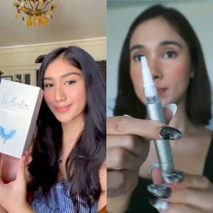 【SMILEKIT Teeth Whitening Kit】 LED Blue Light | No Sensitivity | 4 Gel Pens | Wireless & USB Rechargeable