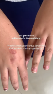 The Bath Box Goats Dont Lie Geranium Liquid Soap (GDL ODL Eczema Eksim Bekas Luka Acne Scars Alergi Gatal-Gatal Psoriasis)