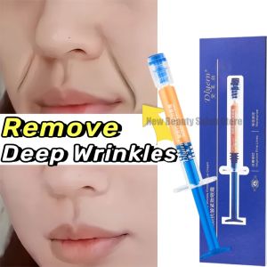 Retinol Wrinkle Remover Face Cream Firming Lifting Anti Aging Fade Fine Lines Moisturizing Whitening Repair Skin Care Cosmetics2026