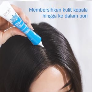 VP 2 Littles Do & Done! - Duo Gel Darurat Jerawat & Ketombe