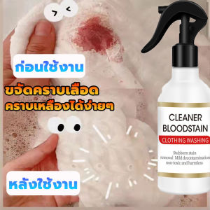 น้ำยา ซักคราบเลือด ขจัด ช่วย ผสมกัน! น้ายากำจัด น้ำยาล้างคราบ สไตล์เบา ประจำ 2 เดือน ผ้า ผ่านเข็มไม้ คล้อง และการเก็บของคราบ ถูกตั้งตัว