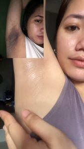 5X UNDERARM WHITENING + DEODORANT COMBO: Greenika Underarm Spray & Whitening Cream