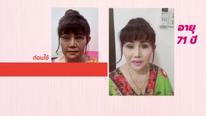 คุ้มสุดๆ 5 หลอด Barcony ครีมยกกระชับ Lifting Perfect บาร์โคนี่ นวัตกรรมความงามจากเกาหลี