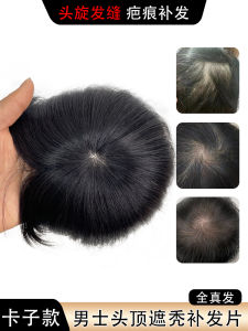 Wig Set Mens Full Real Human Hair Twist Hair Seam Men Hair Replacement Cover Scar Top Sparse Hair Loss Hair Supplementing Piece