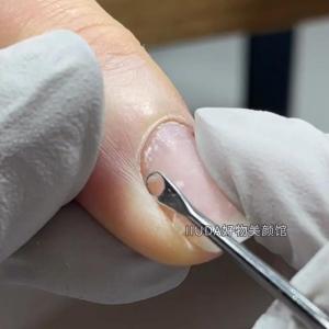 Nail Steel Push Russian Circle Oblique Head Shovel Double-Headed Multi-Purpose Stainless Steel Scraping Dead Skin Care for Nail Beauty Shop Tools