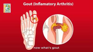 Lakewood Gluten Free Organic Pure Tart Cherry (32oz x 3)