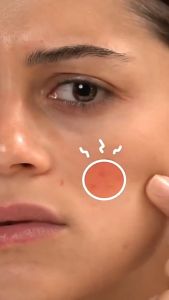 COD Acne Patch Jerawat Hologram Transparan Bening Tahan Air Sakura Butterfly Kupu Kupu Star Love