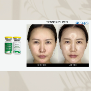 STAYVE Seanergy Peel Ampoule มาร์คบำรุงผิวหน้า ช่วยขจัดเซลล์ผิวได้อย่างล้ำลึก **ของแท้ นำเข้าจากเกาหลี**