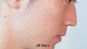Acne Cream&Care Anti Acne Cream30gAcne treatment Acne scar removal Whitening Skin Redness of the skin