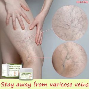 EELHOE Varicose Veins Cream Obat Varises Kaki Ampuh