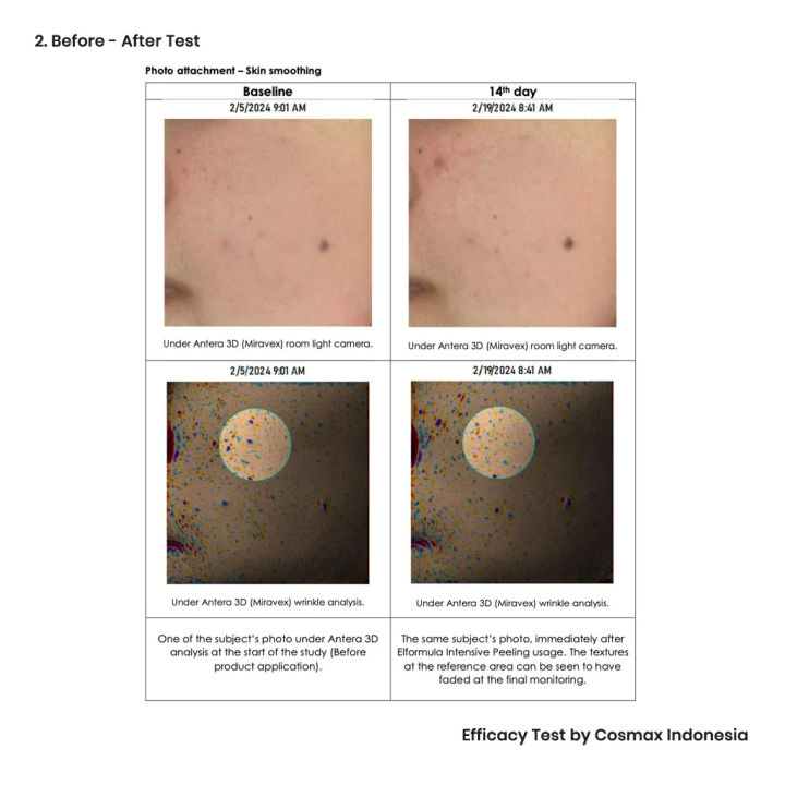 ELFORMULA%20Intensive%20Peeling%20Solution%20-%20Dark%20Spot%20Exfoliating%20Serum%20Facial%20Exfoliation%20Brightens%20and%20Removes%20Dead%20Skin%20Cells%20with%20Centella%20Asiatica%20-%20Image%205