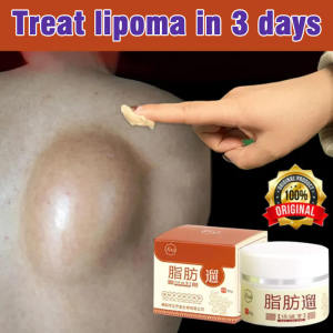 Advanced Anti-Fat Lump Cream - Fast Pain Relief for Lipoma & Lymphoma Treatment