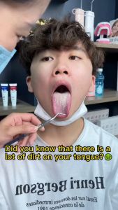 Tongue Coating Cleaning Gel Scraper Fresh Remove Oral Odor To Cleaner for Bad Breath Clean 舌苔清洁器