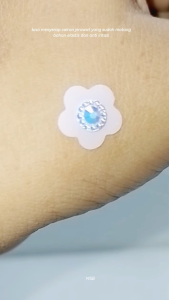 MSB Acne Pimple Patch Hydrocolloid Karakter Warna Lucu/Acne Patch Lucu/Sticker Jerawat Warna Lucu