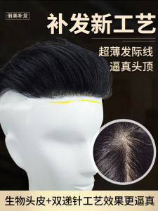 Men Wig Head Hair Replacement Mens Short Delivery Needle Real Hair Hairpiece Forehead Hairline Invisible Seamless Biological Scalp