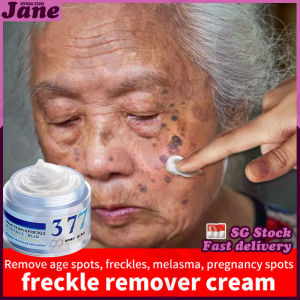 🎈SG stock🎈 377 whitening cream / 50g Freckles removal cream / Dark spot remover / Melanin removal cream / 377美白淡斑霜 / 377 美白祛斑