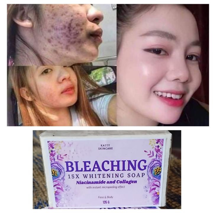 Bleaching Collagen 15x Instant Whitening Soap 120g Lazada Ph 3046