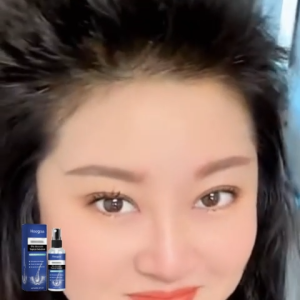 【BUY 1 TAKE 1】Eelhoe 5% Minoxidil Topical Solution Hair Growth Spray For Thicker Hair Growth Hair Regrowth Serum Hair Loss Treatment For Men And Woman 60ml