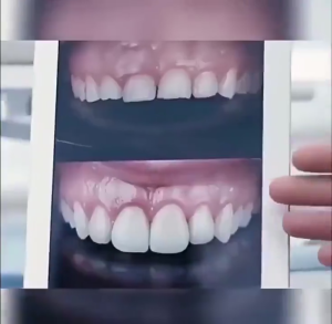 Pasta gigi soda garam laut dalam pasta gigi pemutih 100g memutihkan gigi dengan cepat menghilangkan karang gigi pasta gigi pemutih paling efektif napas segar menghilangkan bau mulut pasta gigi pemutih mint perlindungan gigi