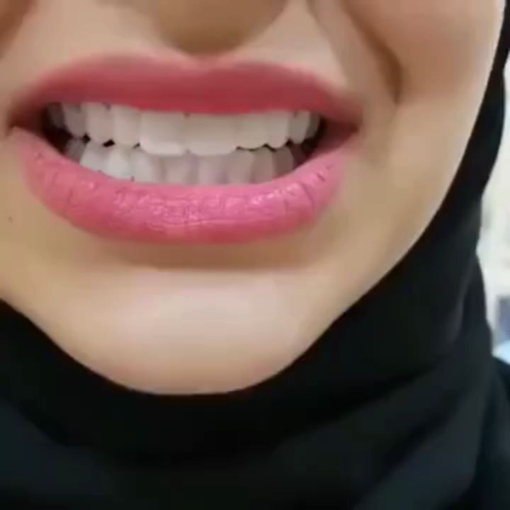 COD gigi palsu yang viral di tiktok Snap On Smile 100% Original