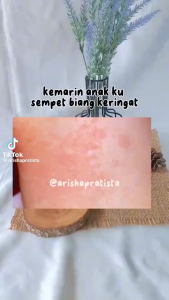 BEDAK GATAL HEROCYN BABY | DEWASA Biang Keringat Bau Badan Kulit Gatal