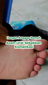 NATURAFIT Asmurathib - Obat Herbal Sendi Untuk Asam Urat Nyeri Lutut Pinggang Saraf Kejepit Meluruhkan Kristal Asam Urat Dalam Darah Untuk Gout