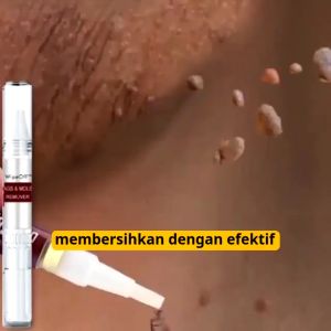 Penghilang Kutil Dan Tahi Lalat Penghilang Kutil Di Wajah Penghilang tahi lalat di wajah Skin tag remover kutil di leher