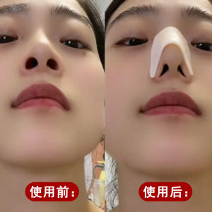 Thermoplastic Nasal Splint Low Temperature Self-Pinch Correction Shaping Nose Post-Operation Fixator Nasal Wing Reduction Handy Gadget Splint Genuine Goods