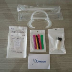 Paket behel gigi murah dan lengkap