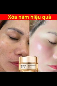 kem xóa nám kem collagen kem xóa nám chống lão hóa xóa nám hiệu quả làm mờ vết thâm nám tàn nhang đồi mồi săn chắc dưỡng ẩm da mặt