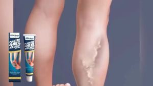 Plantar Fasciitis Relief Cream Foot And Ankle Alleviate Foot Muscle Stiffness Lessen Pain From Walks Improve Foot Flexibility