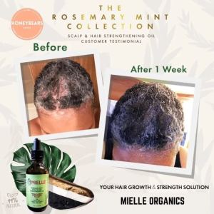 Rosemary Hair Growth Essential Oil 59ml Anti Hair Loss Fast Regrowth Essence Aromatherapy Repair Damaged Frizzy Thinning Scalp Hair-restorer Dense Hair Growth Serum