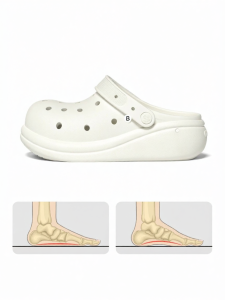 chikoku | Arch Support Breathable Anti-slip Thick-soled Clogs