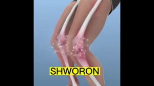 Bee Venom Ointment: A Natural Solution for Joint & Knee Pain Relief