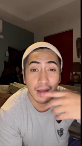 Lip Serum for Men Hydrating Lighten Fine Lines Cracked Dry Repair Moisturizing Skin Brightening