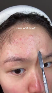 Dr. Althea 345/147 Relief Cream Repair Stressed Skin Post-Acne Barrier Care Niacinamide Panthenol Ceramide