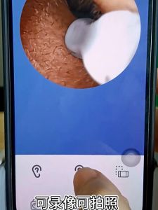 CylRedbat 2.5mm ไม้แคะร่างกายแคะหูมีกล้อง 1080P HD และไฟLED เชื่อมต่อ WiFi กล้องจิ๋วส่องตรวจหู สำหรับส่องรูห พร้อมช้อนหู 5 อัน