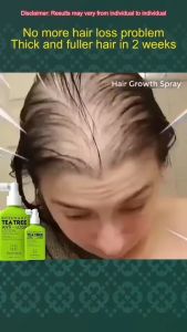 Xịt dưỡng da đầu chăm sóc tóc và bảo vệ da đầu Beamarry