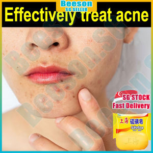 ⭐️𝙎𝙂 𝙨𝙩𝙤𝙘𝙠⭐️ Shanghai sulfur soap / Sulphur soap/ Anti fungal soap / Acne soap bar / Antibacterial eczema soap  硫磺肥皂 上海硫磺皂