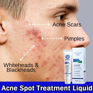 Remove Pimples Acne Treatment Cream Anti Acne Remover Fades Acne Marks Repairs Acne Pits Facial Scar Care Pimple Eraser Acne Treatment Cream Acne Scar Remover Acne Repair Cream 25g