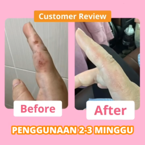 ZÉRA Mom - BerryC Skin Soothing Hand Wash | Gentle Antibacterial | Moisturizing | pH Balanced | Non-Drying Formula 500ml