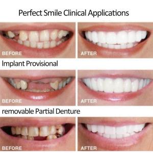 PAKET HEMAT! 1 Set Gigi Palsu Snap on Smile Gigi Tiruan Gigi Palsu Asli Kuat 100% Original